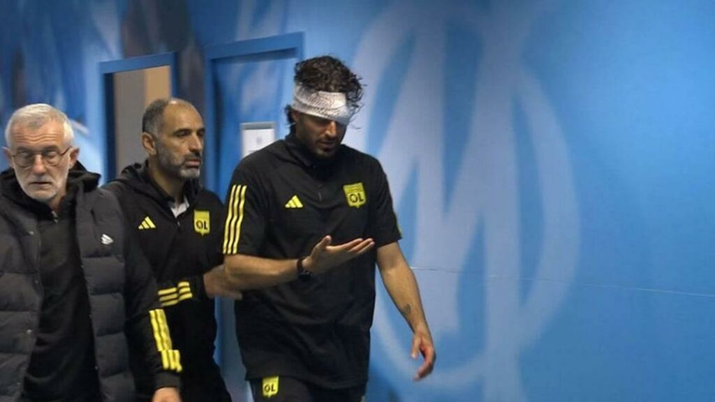 بالفيديو| رشق حافلة ليون بالحجارة وإصابة دامية للمدرب