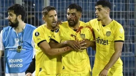 حجر أرجنتيني يصيب مدافع بينارول الأوروغوياني