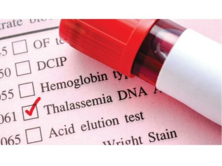 تحذير من الحمل الطبيعي للأزواج مصابي الثلاسيميا