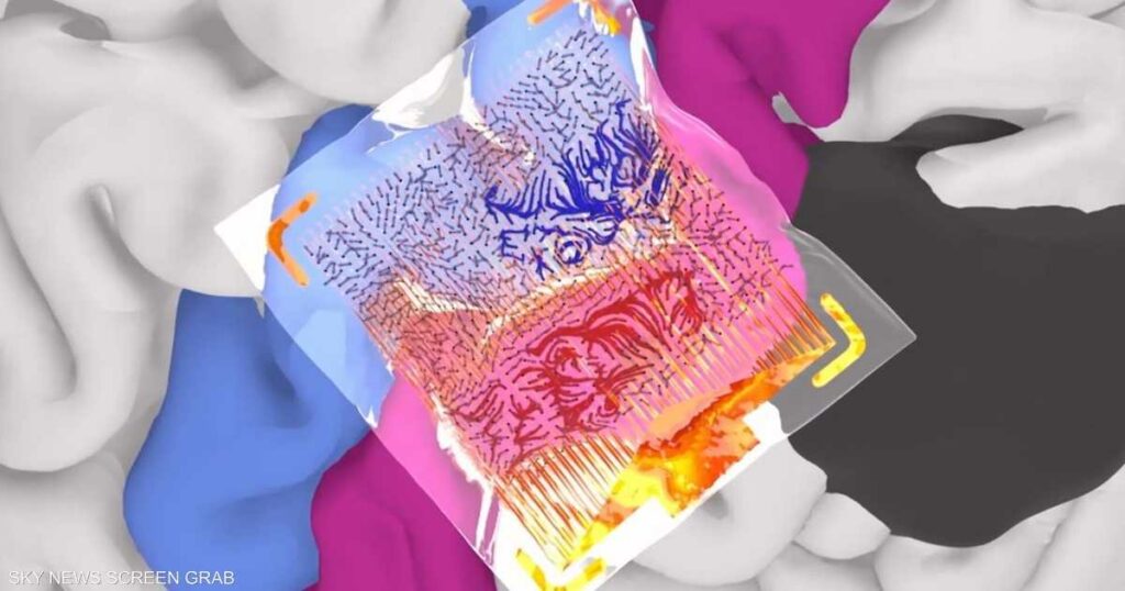 تفوق شريحة ماسك.. شريحة دماغ "عربية" تمهد لاتصال المخ بالـAI