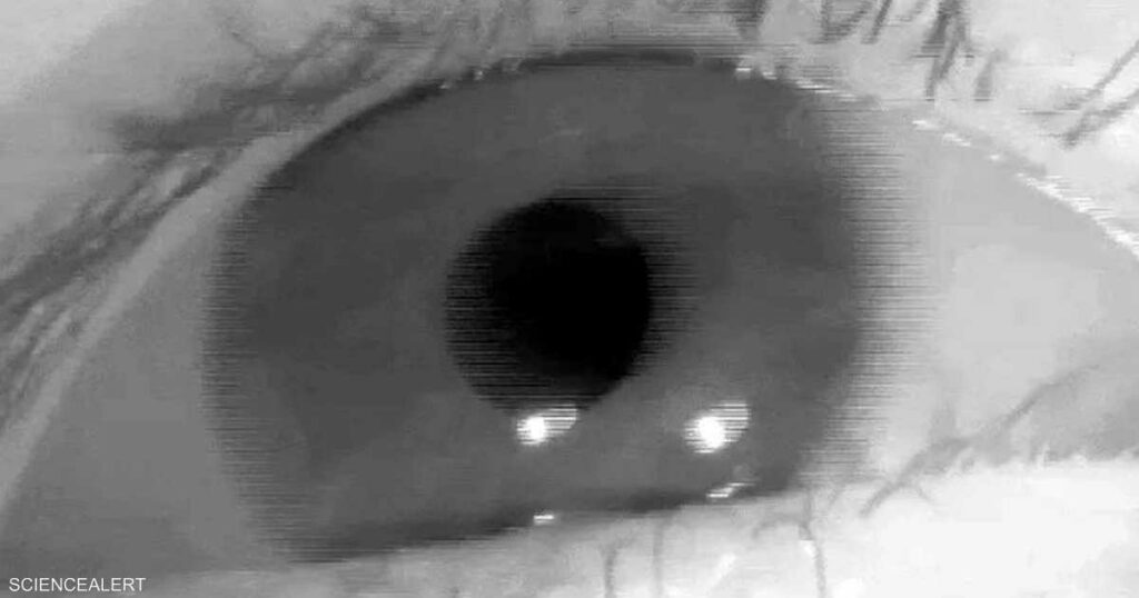 دراسة: العين قد تتنبأ بالخرف قبل بـ12 عاماً من التشخيص