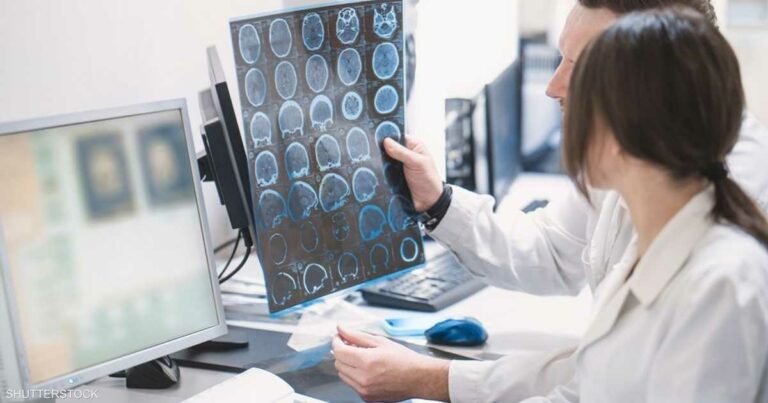 الولايات المتحدة تجيز أول فحص دم يتيح تشخيص الزهايمر