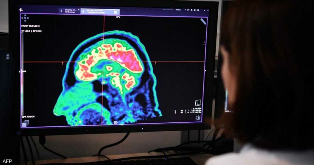 هل يمكن لمخ البشر تجديد خلاياه؟.. دراسة تحسم الجدل