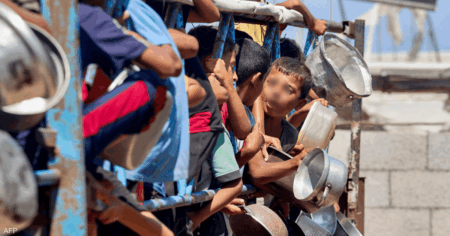 بسبب المجاعة.. آثار "مدمرة ودائمة" تنتظر أطفال غزة