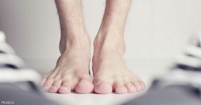 7 علامات على القدمين.. مؤشر لمشاكل صحية خطيرة