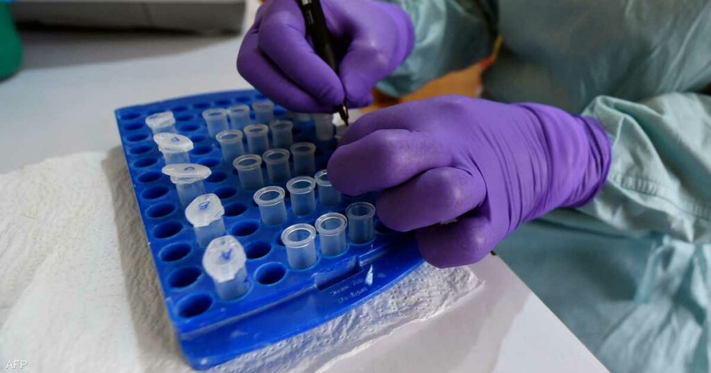 تسببت بوفيات في غزة… ماذا نعرف عن متلازمة "غيلان باريه"؟