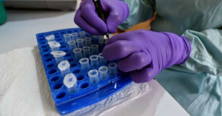 تسببت بوفيات في غزة… ماذا نعرف عن متلازمة "غيلان باريه"؟