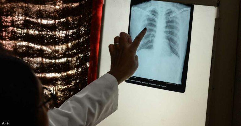 9 أعراض قد تكون من العلامات المبكرة لسرطان الرئة