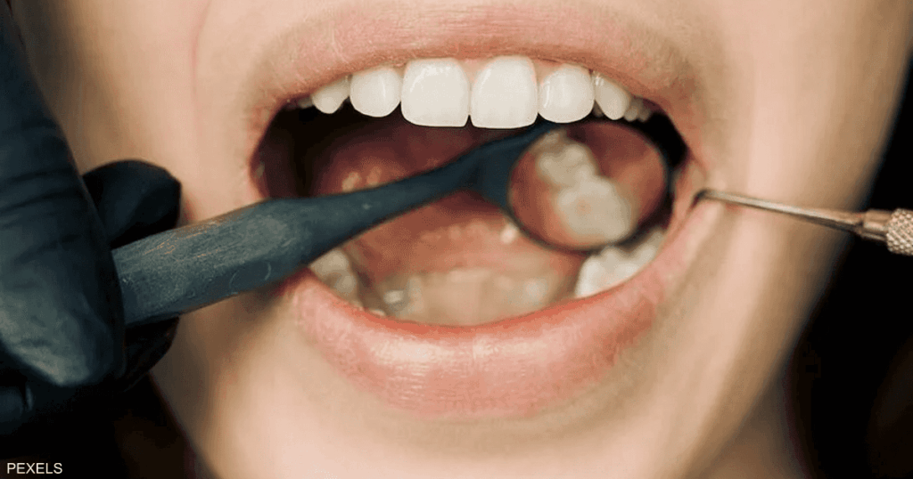 اكتشاف حلقات عملاقة من الحمض النووي.. تقلل خطر السرطان