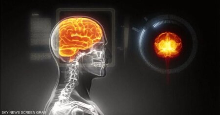 الشيخوخة المبكرة للدماغ.. دراسة تكشف الرابط "الخفي"