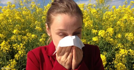4 طرق طبيعية لتسريع الشفاء من الحساسية الموسمية