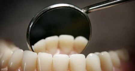 دراسة: فقدان الأسنان يرفع خطر الوفاة