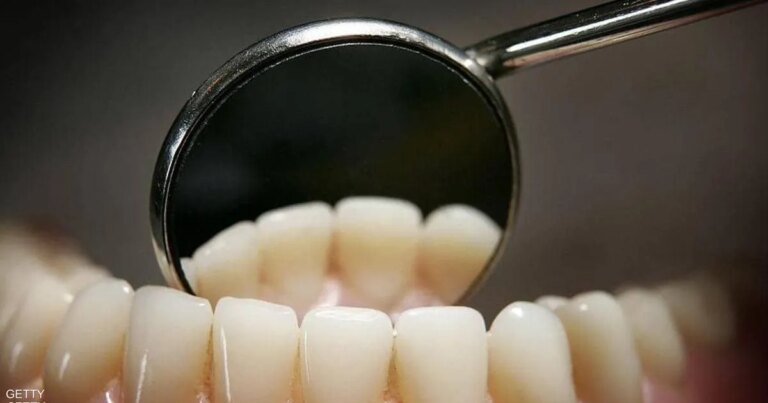 دراسة: فقدان الأسنان يرفع خطر الوفاة