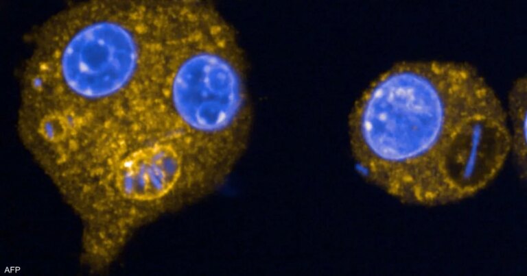 "بكتيريا قاتلة" تنتشر.. تحذير من منظمة الصحة العالمية