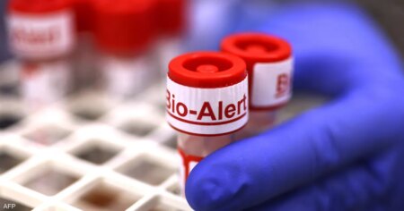 تفشي ماربورغ بإثيوبيا يثير مخاوف.. استنفار صحي لتفادي الأسوأ