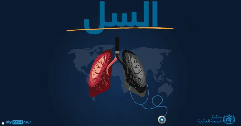 الصحة العالمية تكشف عن "أخطر الأمراض المعدية فتكا" في العالم