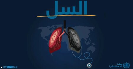 الصحة العالمية تكشف عن "أخطر الأمراض المعدية فتكا" في العالم