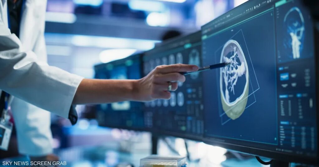 أداة ذكاء اصطناعي تتفوق على الجراحين في زراعة الأعضاء