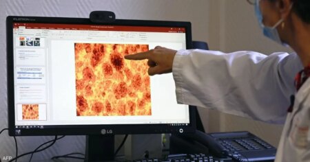 عقار جديد يضاعف متوسط البقاء على قيد الحياة لمرضى سرطان البنكرياس عقار جديد يضاعف متوسط البقاء على قيد الحياة لمرضى سرطان البنكرياس