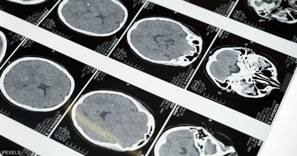 اكتشاف علمي جديد يغير المفاهيم: الدماغ ليس عضواً واحداً