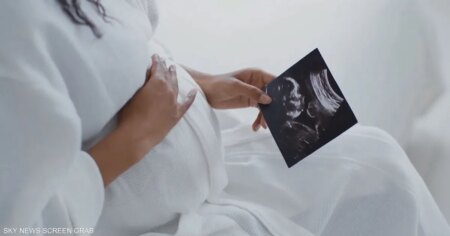 دراسة تحذر من ارتباط أدوية حديثة للصداع النصفي بزيادة خطر الإجهاض