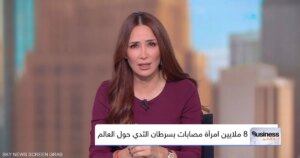 ابتكار دوائي جديد يبشر بتغيير مسار علاج سرطان الثدي