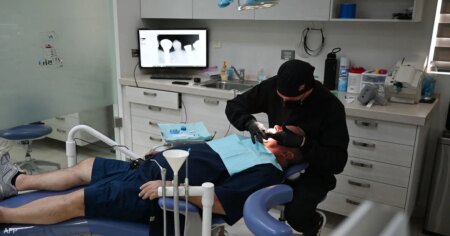 أسباب فشل زراعة الأسنان رغم استخدام المضادات الحيوية